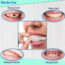 Load image into Gallery viewer, Perfect Smile Pro - Snap On Smile Veneers ( Upper & Lower Set )