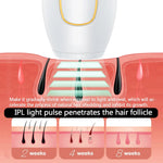Pro Skin - IPL Hair Removal Machine ( Advanced Technology )