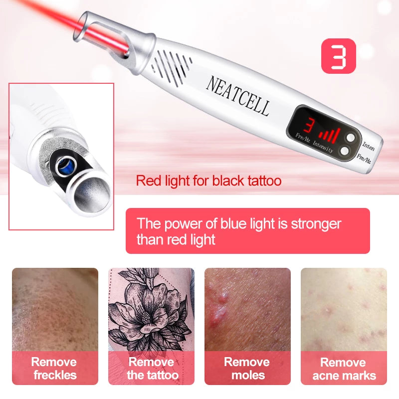 Smart Tattoo Removal Laser Pen - Remove Moles, Freckles, Acne, Tattoo