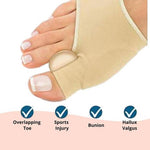 Feel Great Orthopedic Toe Bunion Corrector 2.0 - 1 Pair (Left + Right)