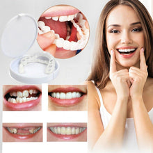Load image into Gallery viewer, Perfect Smile Pro - Snap On Smile Veneers ( Upper & Lower Set )