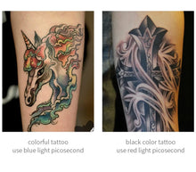 Load image into Gallery viewer, Smart Tattoo Removal Laser Pen - Remove Moles, Freckles, Acne, Tattoo
